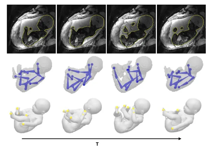 Figure from: Fetuses Made Simple: Modeling and Tracking of Fetal Shape and Pose
